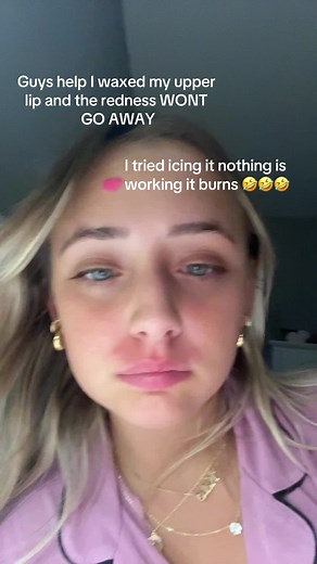Giải pháp giảm đỏ sau khi waxing môi trên