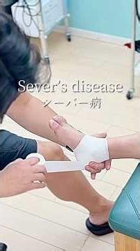 かかとの痛みにテーピングをしました