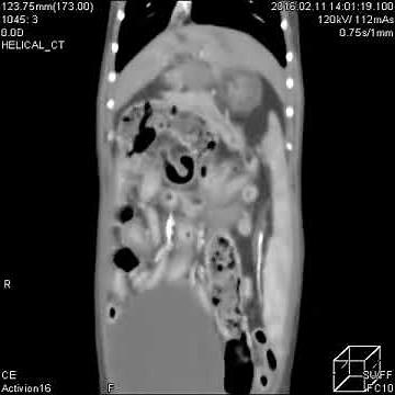 猫の腹腔内腫瘍（リンパ腫）（CT動画）＿松波動物病院メディカルセンター