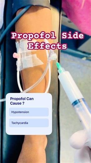 Milk of Amnesia ( Propofol ) Side Effects. #propofol #anesthesiology #icu #anesthesiaresident