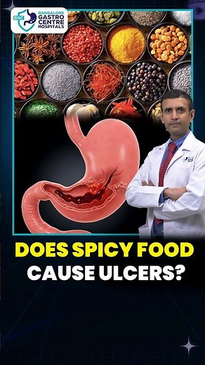 Stop Blaming Spicy Food for Stomach Ulcers! Real Cause Explained