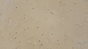 Sperm Spermatozoa Viewed Under Microscope Moving: video de stock (totalmente libre de regalías) 1039781462 | Shutterstock