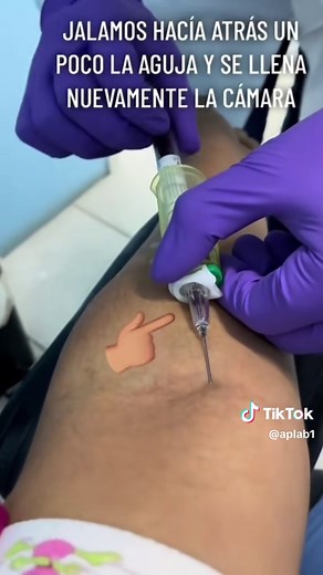 Toma de muestra aguja flashback vacutainer