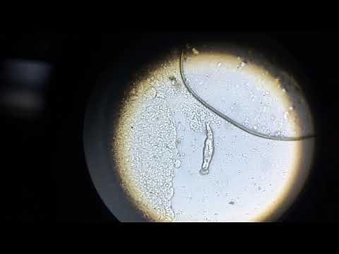 Fluke Parasite Under Microscope