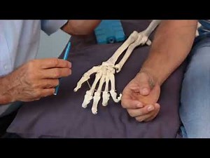 Treating Trigger Points -Thenar Eminence