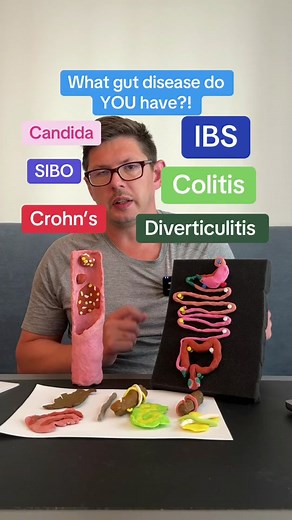 Types of Gut Diseases and Symptoms Explained