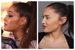 Genuine question, I love Ari but what it going on with her hairline? :/