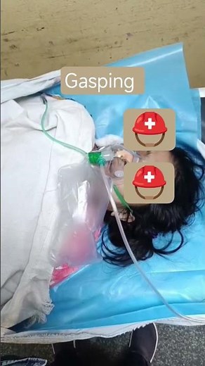 intubation indication