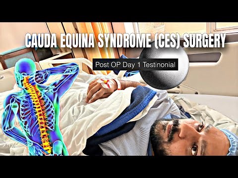 Cauda Equina Syndrome (CES) Surgery_Post Operation🤜🏻 Testimonial | Emergency Spinal Surgery