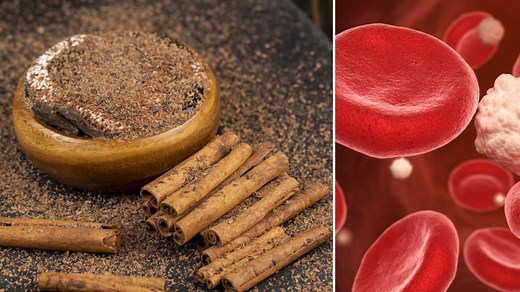 ¿Cómo consumir la canela para reducir el azúcar en la sangre y bajar los triglicéridos de forma natural?