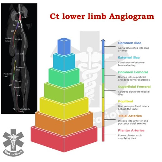 CT Angiography: A Key Tool for Peripheral Artery Disease Evaluation | Mohideen S posted on the topic | LinkedIn