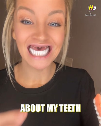 This is how teeth dentures works in a normal day!🦷 | Hollywood Journal