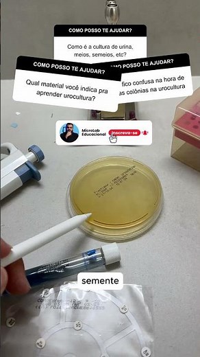 How is a urine culture performed in the Clinical Analysis laboratory?