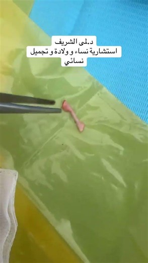 ألم الجماع عند النساء | أهم الأسباب ولماذا الفحص النسائي ضروري؟ 📚