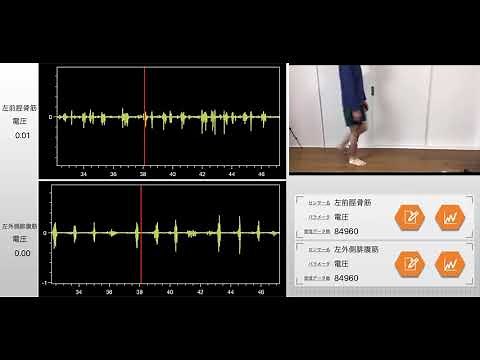 理学療法士・歩行を筋電計で測定！！