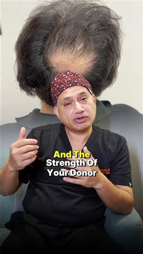 8 FUT versus fue final FUT vs FUE – Doctors Don’t Explain This Clearly