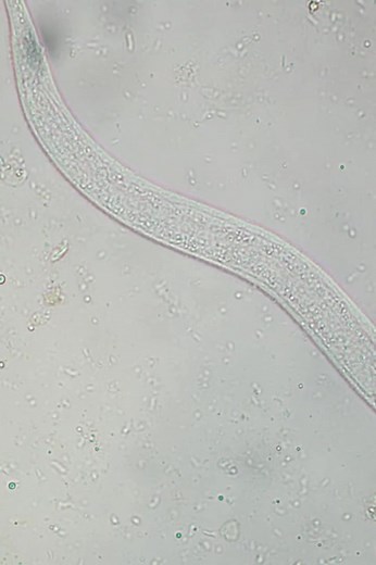 Stool sample 😍 #lablife #diagnostics #MedicalLabTechnician | Lab life