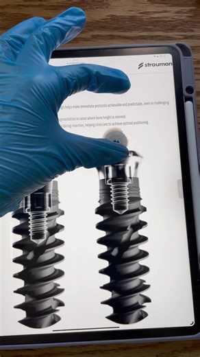 Dynamic Bone Management —​ Straumann’s unique implant design aims to make immediate protocols achievable even in challenging situations. Ready to discover innovation? Click the link to learn more.​ * Not all implant lengths and diameters are available in all markets. ifu.straumann.com | Straumann