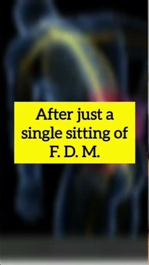 Fascial Distortion Model FDM in a partner clinic of ETAMED in India 🇮🇳💪😊👍