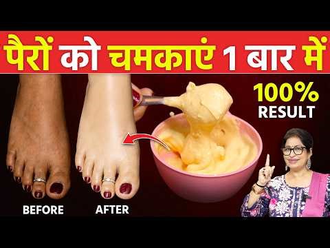 पैरों पर जमी सालों पुरानी मैल और गंदगी को निकाले - 1 जादुई चीज से | DIY FEET BRIGHTENING REMEDY