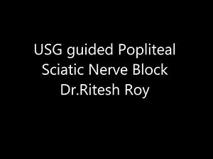 Ultrasound guided Popliteal Sciatic nerve block