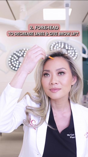 3 injection places to get botox for a younger loooking face. #fyp #antiaging #howtolookexpensive #howtolookyounger