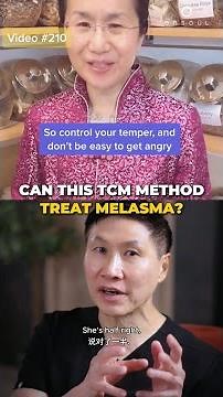 Does TCM work for Melasma #tcm #melasma #pigmentation #skinpigmentation #reaction #reactionvideo