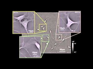 Quantitative differential phase contrast imaging in an LED array microscope