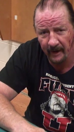 Terry Funk Calls Out Hannibal After Savage Beat Down Hannibal Wrestler Playlist: https://www.youtube.com/playlist?list=PLvoIHF4T3-L4USbdEQ3Yc756QVw-E94Zn Subscribe to The Hannibal TV on YouTube: https://www.youtube.com/@TheHannibalTV Follow The Hannibal TV on Facebook, Instagram & Twitter The Hannibal TV | The Hannibal TV