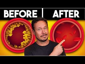 The BEST Meal to Clean Out Your Arteries
