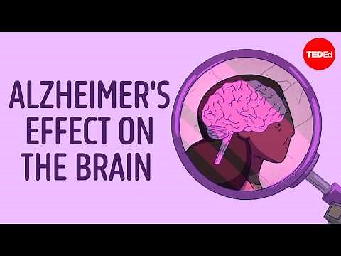 Why is Alzheimer’s disease so difficult to treat?