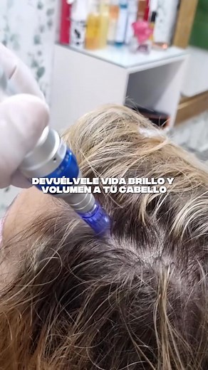 🤔💭¿𝗣𝗲𝗿𝗱𝗶𝗲𝗻𝗱𝗼 𝘁𝘂 𝗰𝗮𝗯𝗲𝗹𝗹𝗼? ¿𝗤𝘂𝗶𝗲𝗿𝗲𝘀 𝘂𝗻𝗮 𝘀𝗼𝗹𝘂𝗰𝗶𝗼́𝗻 𝗿𝗲𝗮𝗹? 👨‍⚕¿𝗥𝗲𝗰𝘂𝗽𝗲𝗿𝗮𝗿 𝘁𝘂 𝗰𝗼𝗻𝗳𝗶𝗮𝗻𝘇𝗮 𝗲𝘀 𝘁𝘂 𝗼𝗯𝗷𝗲𝘁𝗶𝘃𝗼?😍 Con 👉𝗧𝗿𝗮𝘁𝗮𝗺𝗶𝗲𝗻𝘁𝗼 𝗽𝗮𝗿𝗮 𝗹𝗮 𝗥𝗲𝗴𝗲𝗻𝗲𝗿𝗮𝗰𝗶𝗼́𝗻 𝗖𝗮𝗽𝗶𝗹𝗮𝗿 es posible!👉🥰 ✅Crecimiento capilar revitalizado. ✅Detiene la caída del cabello en su origen. ✅Fórmula no invasiva y sin efectos secundarios graves. ✅Resultados visibles en semanas. ✅Aumenta el grosor y la fortaleza capilar. ✅Restaura tu aut