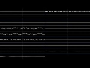 Megalovania - Earthbound Halloween Hack (Oscilloscope View)