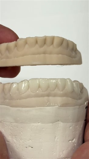 Diagnostic Wax-up Techniques for Dental Preparation