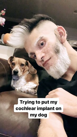 Wait till the end 😂 . . . #deaf #deaftalent #deaflove #deaftiktok #deafproblems #deafcommunity #deafawareness #deafapp #asl #cochlearimplant #signlanguage #hearingaid | Faizy Legend