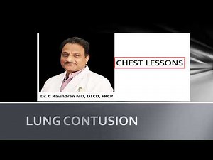 Lung Contusion