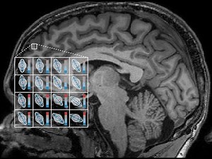 Introduction to Diffusion-Weighted MRI and Microstructure Imaging