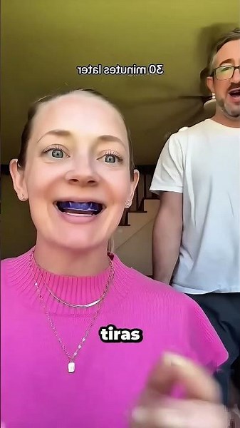 ¿Funcionan de verdad las tiras blanqueadoras dentales? 😲 #teethwhitening #beforeandafter