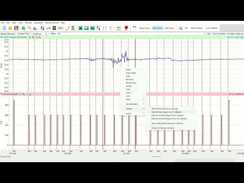 Add Artifact Region to Channel Tool in LabScribe