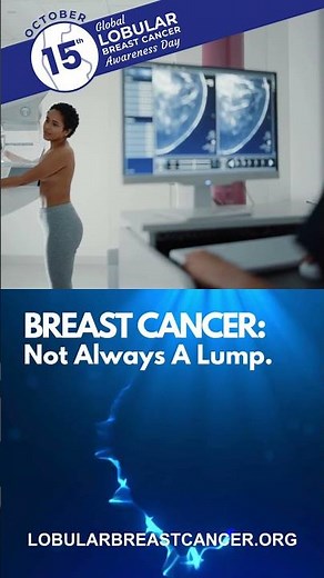 Claudia Shares Her Story with Lobular Breast Cancer