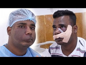 Hemangioma Removal Surgery on the Face: 7 Days Follow up!!