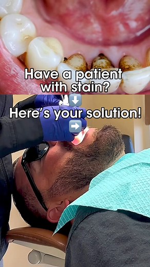 2.2K views · 18 reactions | Have a patient with stain? Reach for Vera...