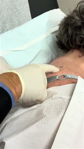 Dr. B Shows What Different Spots on Patient in Clinic #examination #dermatologist