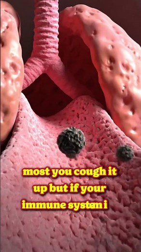 It Grows In Your Lungs: Black Mold Explained #BlackMold #TowelFungi