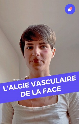 L’algie vasculaire de la face est une maladie neurologique caractérisée par des douleurs faciales très intenses. Diane a dû attendre dix ans avant d’avoir un diagnostic. Elle témoigne aujourd’hui pour faire connaître la maladie. | Doctissimo