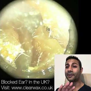 423 - Ear Wax Removal using the WAXscope®️