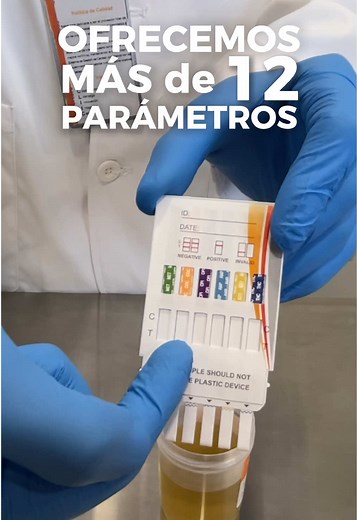Guía Completa para Realizar una Prueba Antidoping