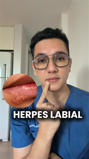 Dr. William Guerrero on Instagram: "Herpes labial: todo lo que debes saber. #medicina #doctorwilliamguerrerodermatologo #drwilliamguerrerodermatologo #dermatologowilliamguerrero"