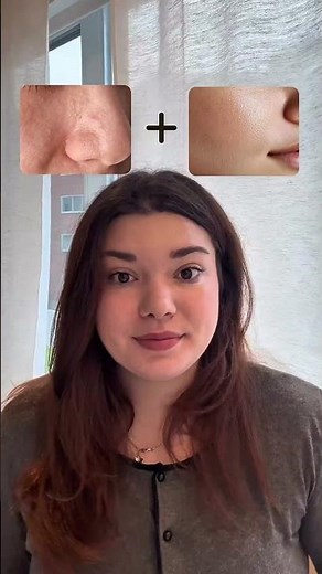 Connaître ton type de peau facilement, depuis chez toi?