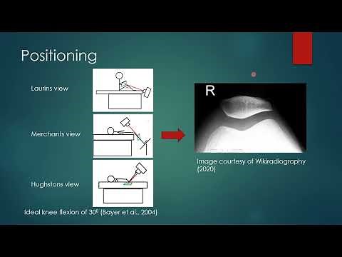 Skyline Patella - Positioning Pearls?